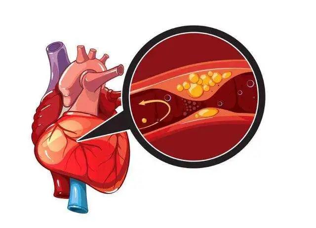 【健鹤宝·南京】冬季常见心脑血管疾病突发，知道这些可以安稳过冬