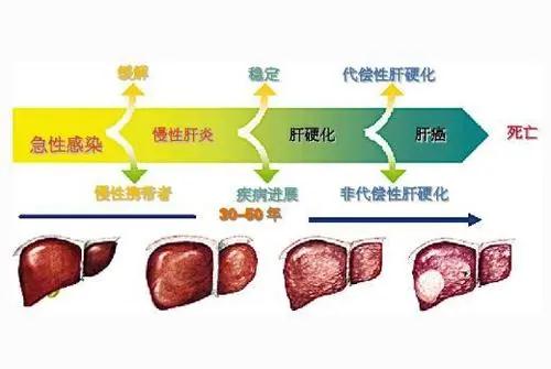 保护肝脏——优质全价的高蛋白营养功能