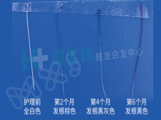 60万一克的“黑科技”富勒烯!黑奥秘让5亿脱发白发人也能用的起了！